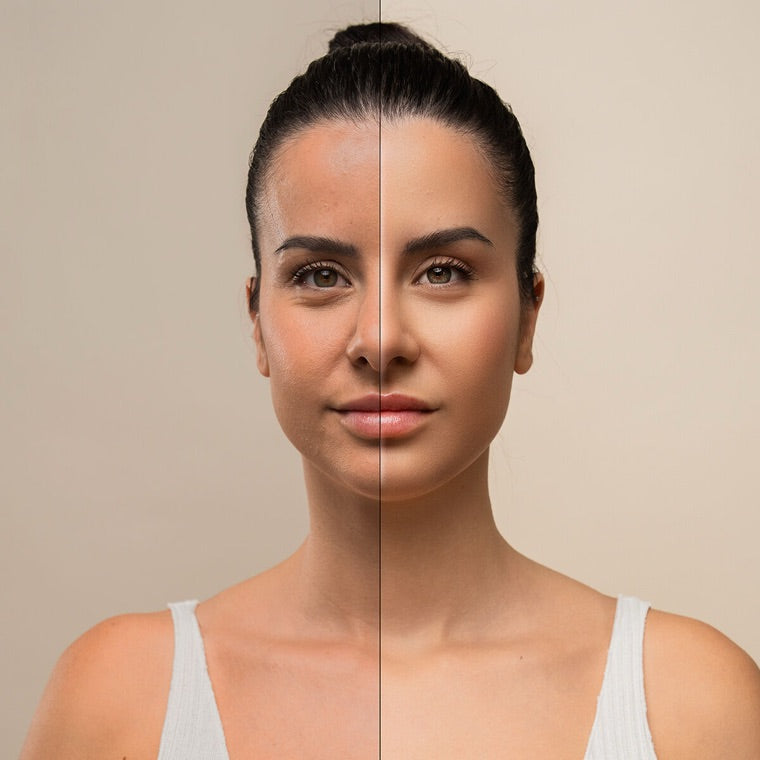 Comparação do aspeto da pele antes e depois de uma rotina de cuidados